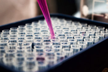 A tray of test tubes being filled with a pipette